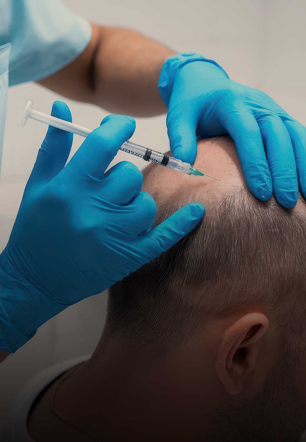 Hair fall treatment in Pune: causes, Cost and solution