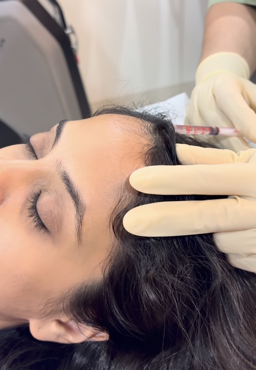 Growth Factor Concentrate GFC treatment in Kothrud Karvenagar PUNE