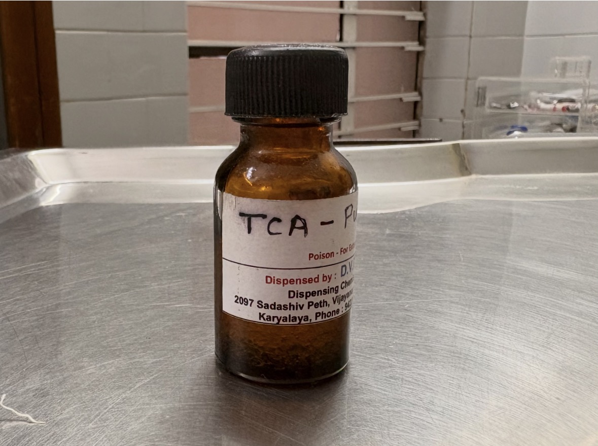 TCA acne scar